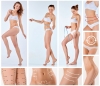 Autologous Fat Transfer: Face, Buttocks & Breast Augmentation Fat Transfer in Delhi Avatar